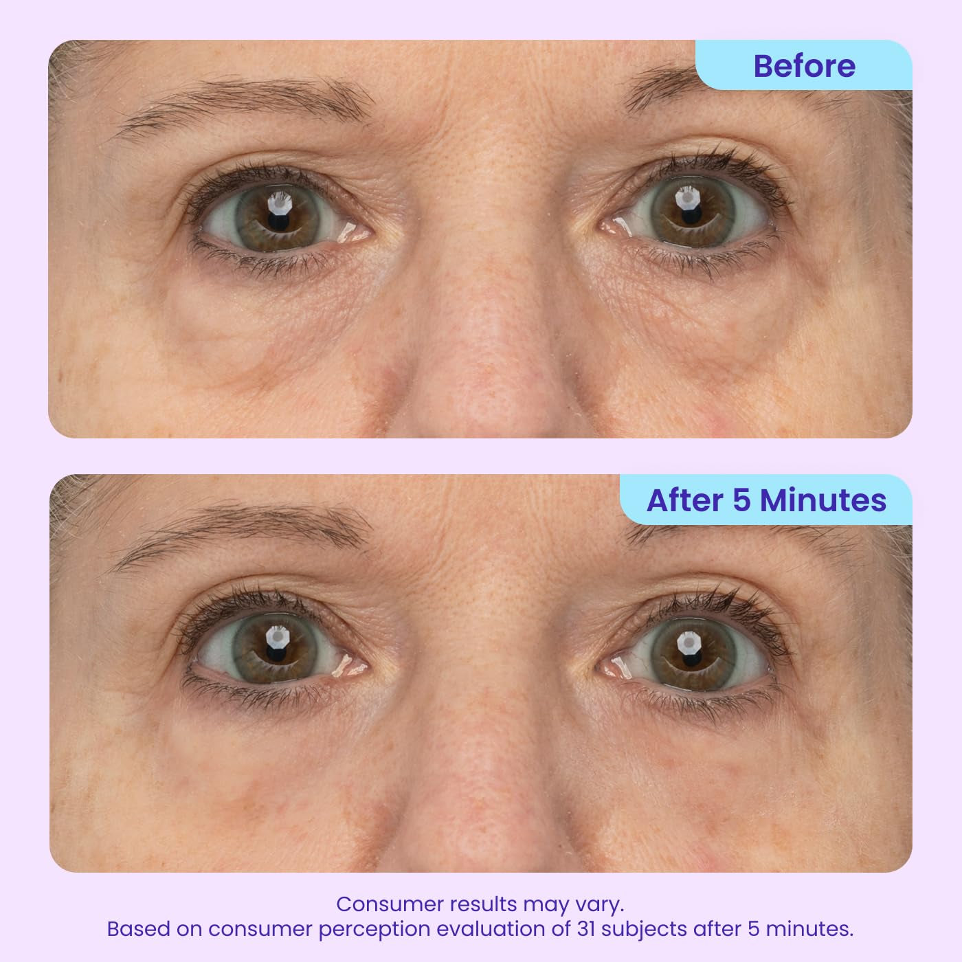 NEW Instant Lift Eye Gel - for the Look of Puffiness & Bags, Wrinkles, Fine Lines and Dark Circles, anti Aging Skin Care for Men & Women with Collagen Targeting Biotech under Eye Brightener