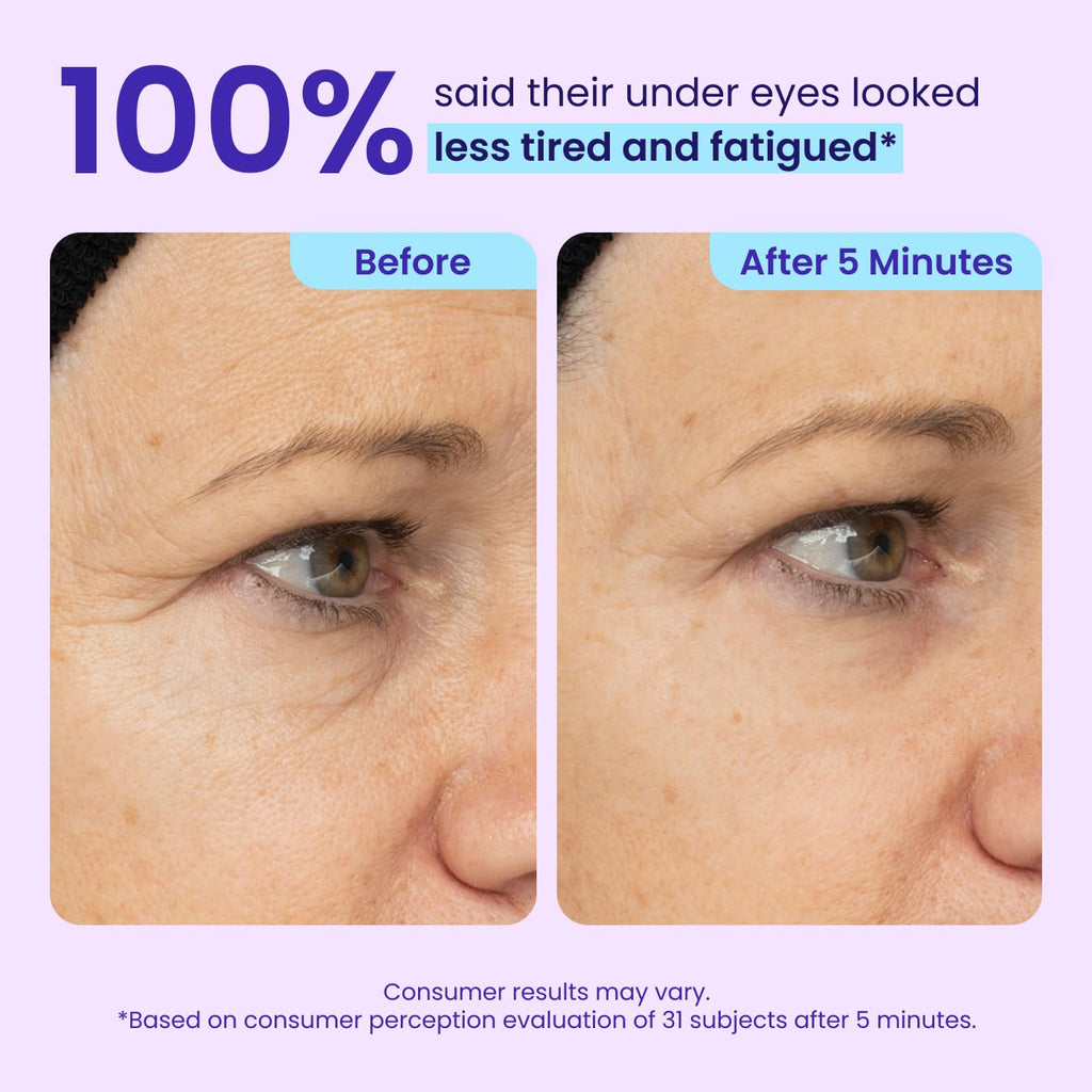 NEW Instant Lift Eye Gel - for the Look of Puffiness & Bags, Wrinkles, Fine Lines and Dark Circles, anti Aging Skin Care for Men & Women with Collagen Targeting Biotech under Eye Brightener