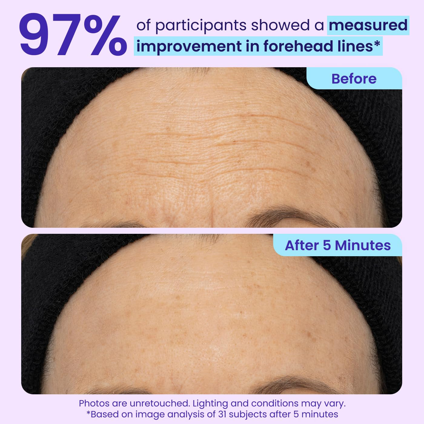 NEW Instant Lift Eye Gel - for the Look of Puffiness & Bags, Wrinkles, Fine Lines and Dark Circles, anti Aging Skin Care for Men & Women with Collagen Targeting Biotech under Eye Brightener